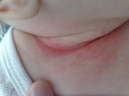 Be careful when your child has a sore throat