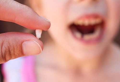 Do children's molars change?