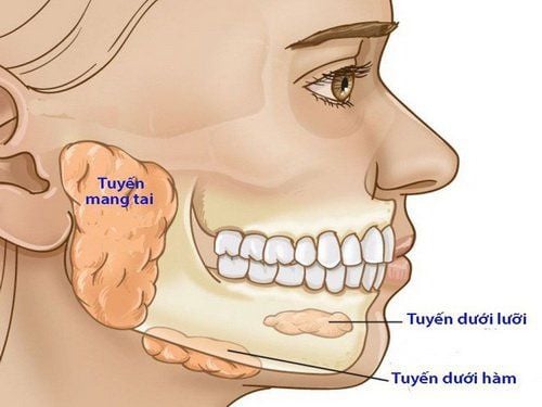 Đau do nhiễm trùng khoang dưới hàm