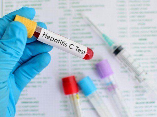 How is acute hepatitis C diagnosed?