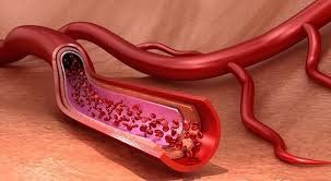 Women's blood vessels age faster