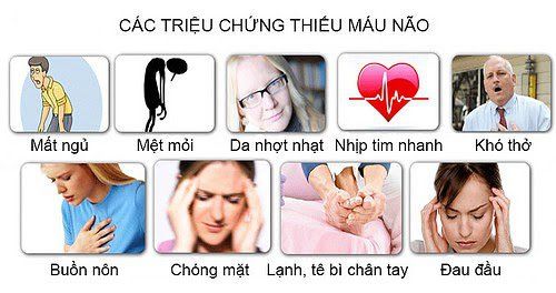 
Một số triệu chứng của tình trạng thiếu máu lên não thường gặp
