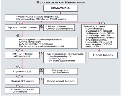 Hematuria: Causes, problems with access and laboratory tests