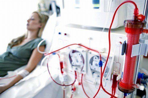 Technical procedure for continuous dialysis in acute rhabdomyolysis syndrome