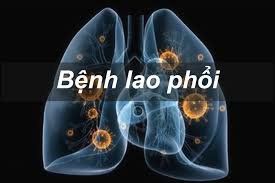 
Hậu quả lao phổi rất đáng sợ
