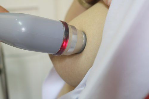 
Sau khi tìm ra nguyên nhân tắc tia sữa thì có thể áp dụng phương pháp laser để điều trị
