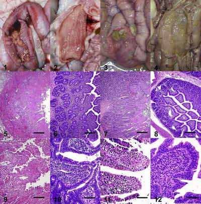 
Nguyên nhân gây bệnh viêm ruột hoại tử là do độc tố toxin của Clostridium Welchi type C
