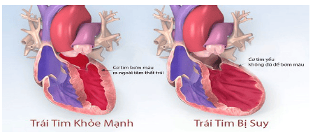 Lưu ý khi dùng thuốc điều trị suy tim