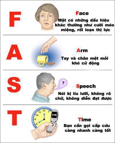 
FAST method to detect stroke
