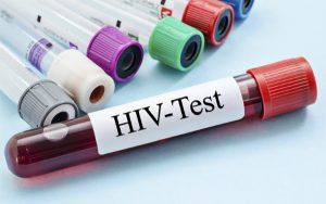 
Minh họa xét nghiệm HIV
