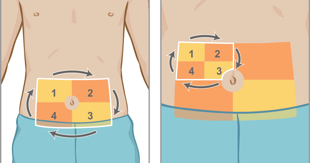 
Luân phiên vị trí tiêm insulin trong điều trị đái tháo đường type 2
