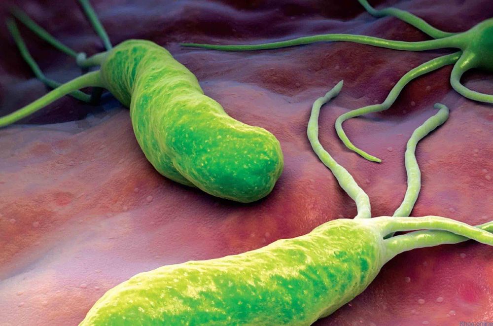 
Vi khuẩn H.Pylori ở dạ dày
