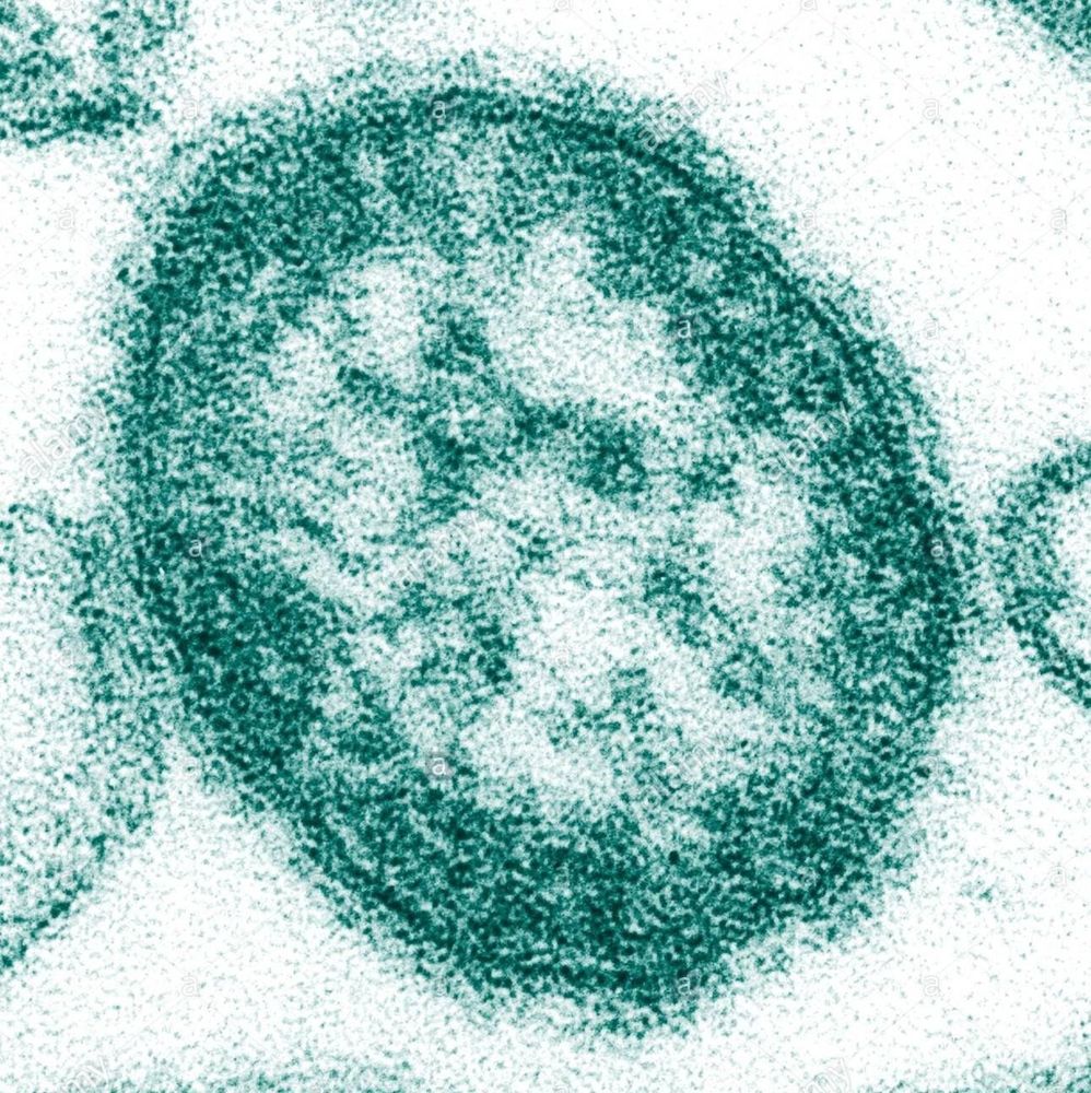 
Paramyxoviridae - virus gây bệnh sởi
