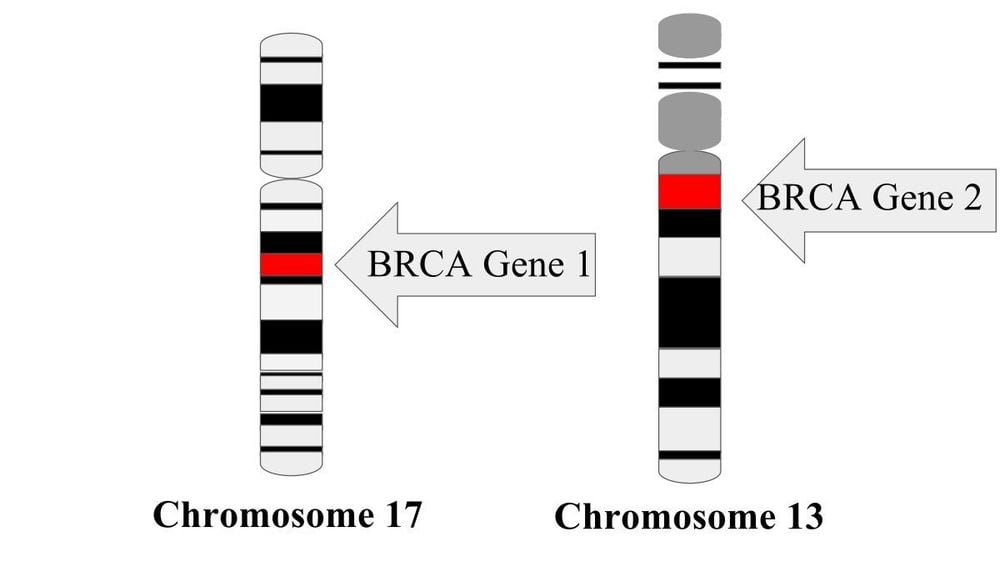 
Vị trí các gen BRCA trên nhiễm sắc thể
