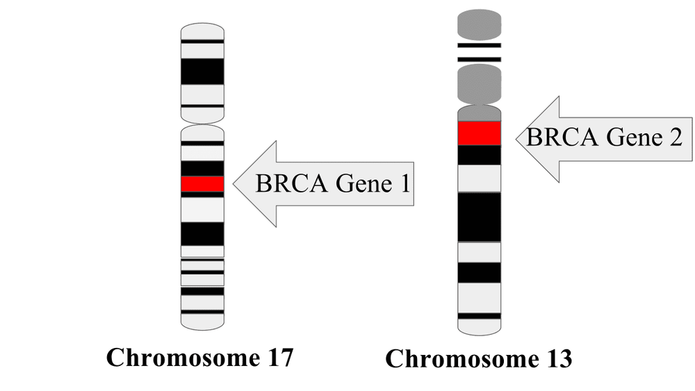 
Vị trí các gen BRCA trên nhiễm sắc thể
