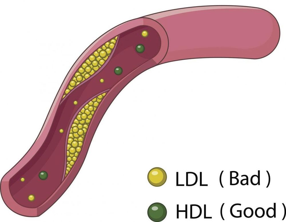 
HDL cholesterol giảm làm tăng nguy cơ mắc các bệnh tim mạch
