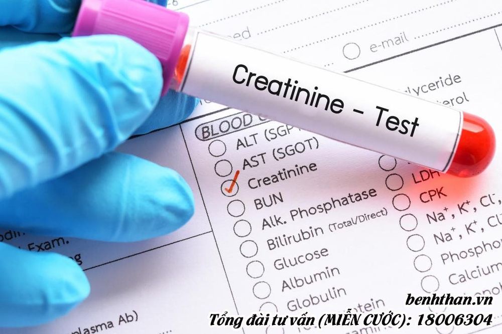 
Mức độ creatinine trong máu cho biết chức năng thận
