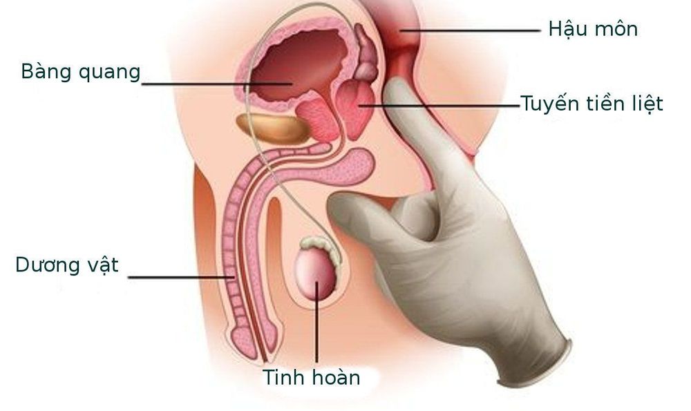 
Vị trí của tuyến tiền liệt
