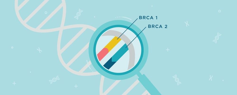 
Đột biến gen BRCA1 và BRCA2 là nguyên nhân chính gây ung thư vú
