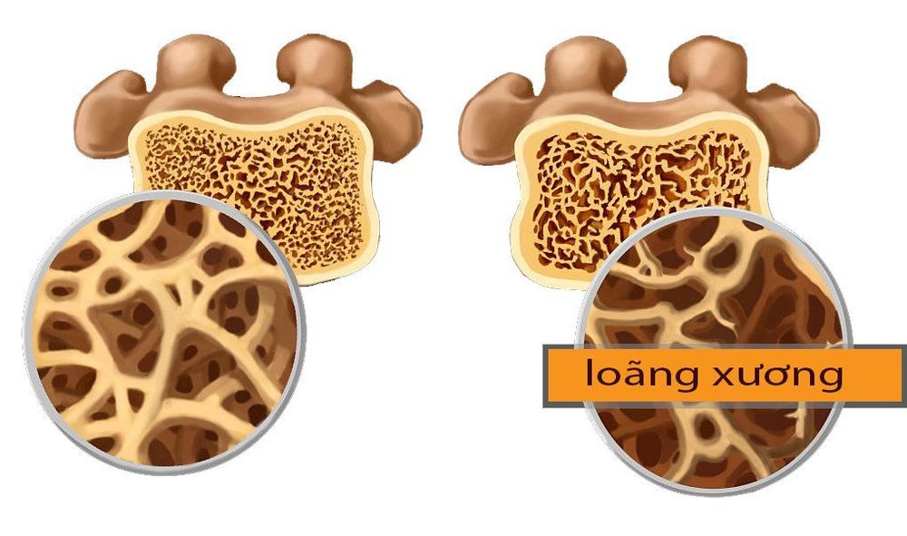 
Quy trình đo mật độ xương thường diễn ra nhanh chóng khoảng 10 đến 30 phút
