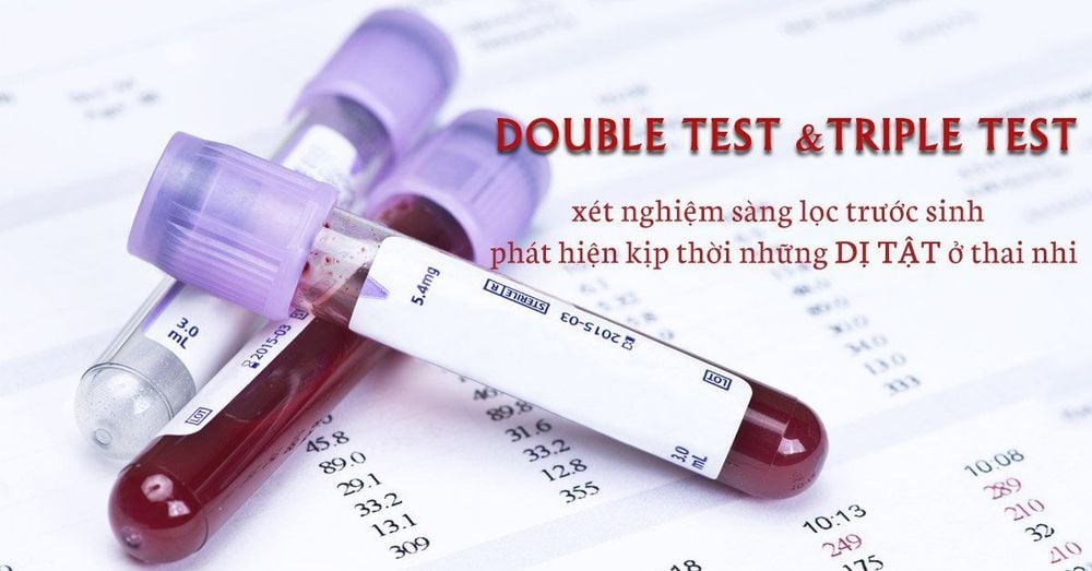 
Xét nghiệm sàng lọc Double test và Triple test giúp sàng lọc hội chứng Down
