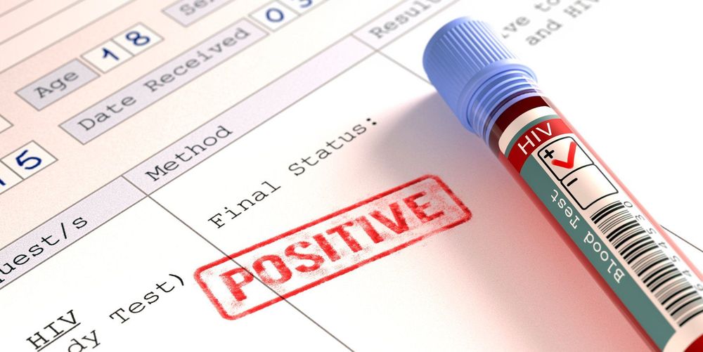 
Kết quả HIV dương tính (positive) nghĩa là bạn đã bị nhiễm HIV
