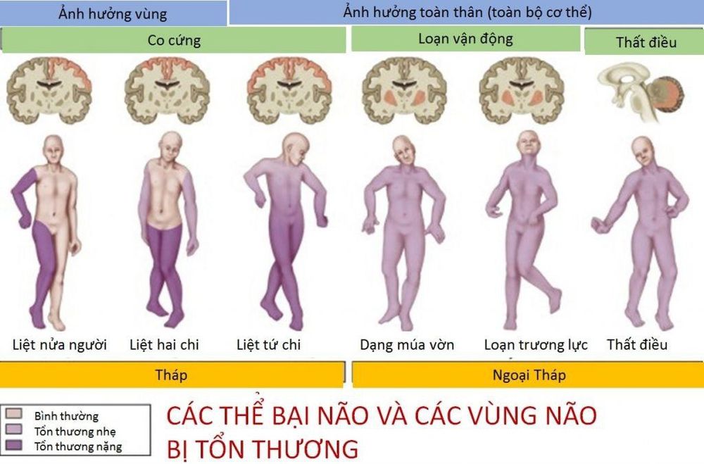 
Các thể bại não
