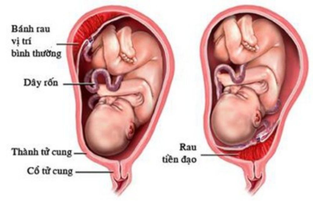 
Hình ảnh rau tiền đạo
