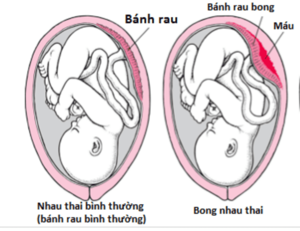 
Hình ảnh rau bong non
