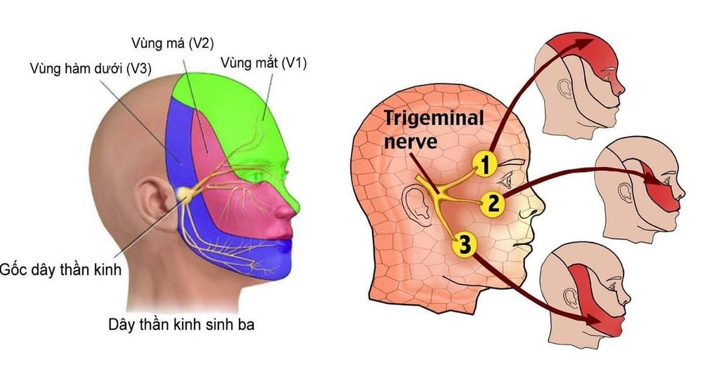 
Đau dây thần kinh số V
