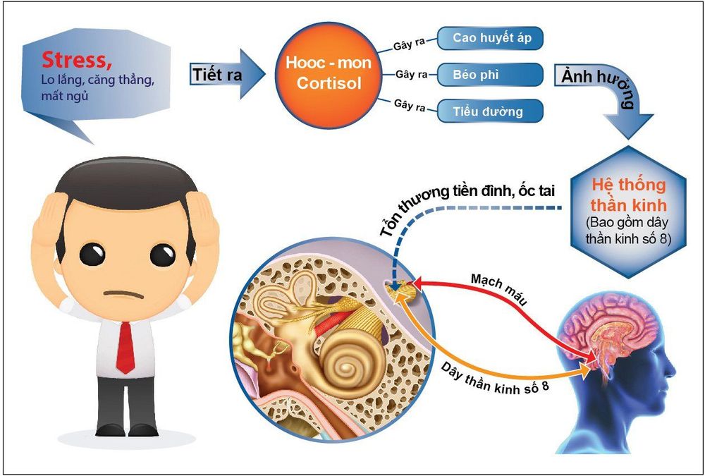 
Stress là nguyên nhân dẫn tới rối loạn tiền đình
