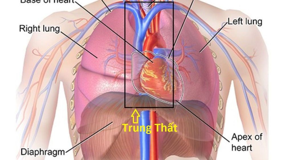 
Chỉ định chụp DSA tĩnh mạch và đặt lưới lọc tĩnh mạch chủ dưới trong trường hợp u trung thất
