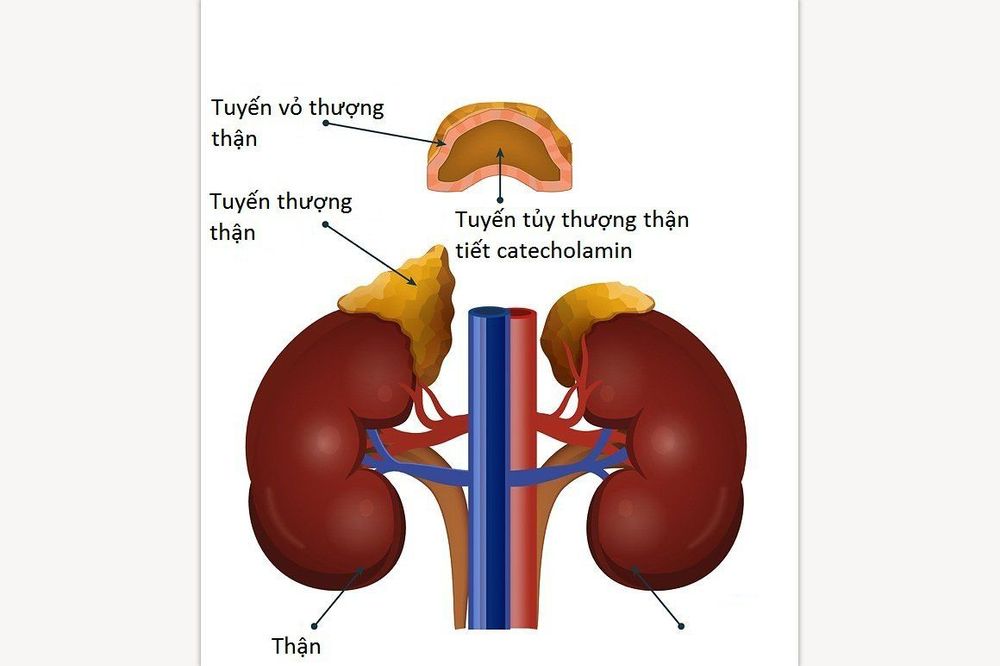 
Bệnh u tuỷ thượng thận
