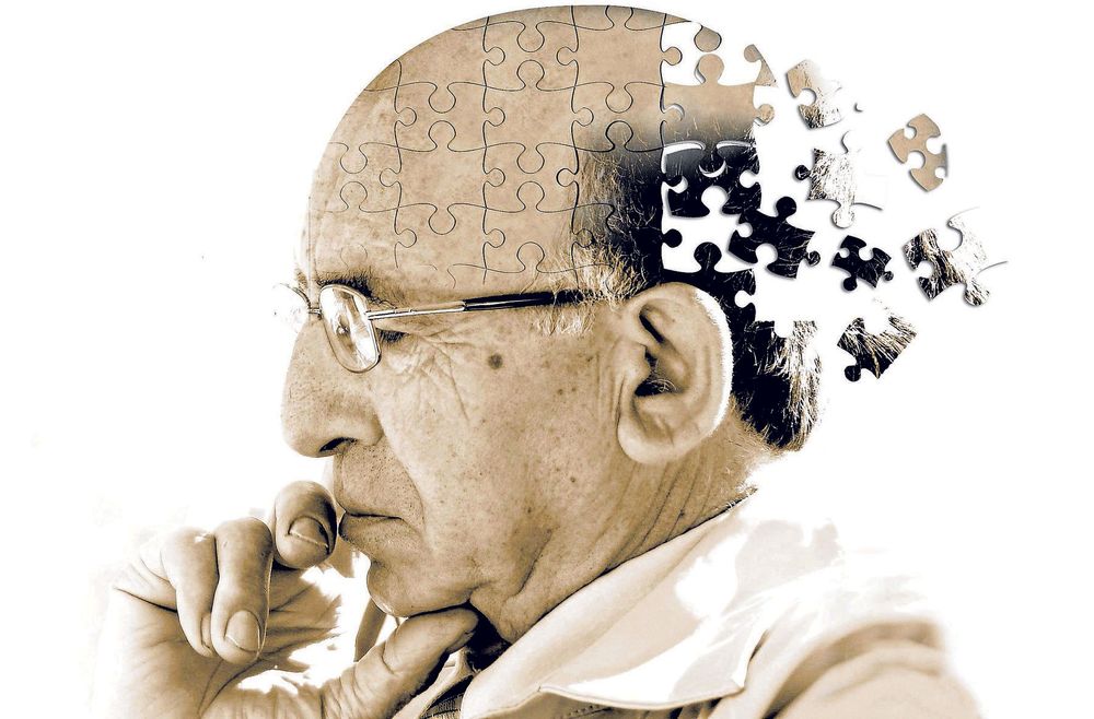 
Chất béo nội tạng dư thừa trong cơ thể làm tăng nguy cơ mắc bệnh Alzheimer
