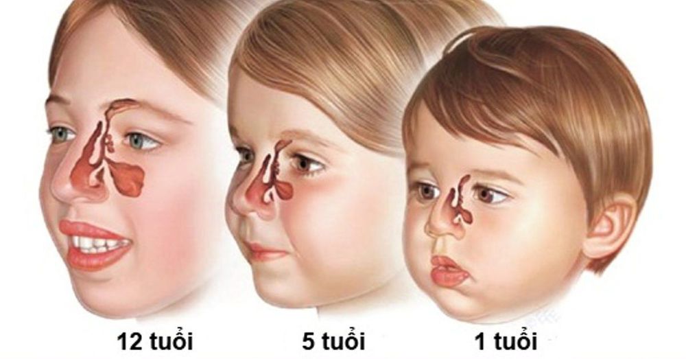 Hình ảnh mũi xoang ở trẻ qua từng giai đoạn