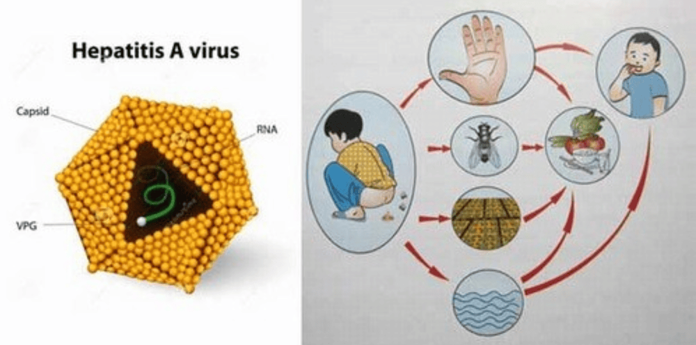 
Con đường lây bệnh của virus viêm gan A
