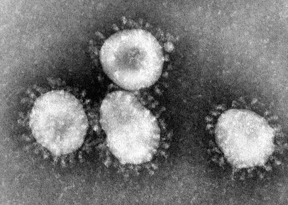 
SARS coronavirus (SARS-CoV)
