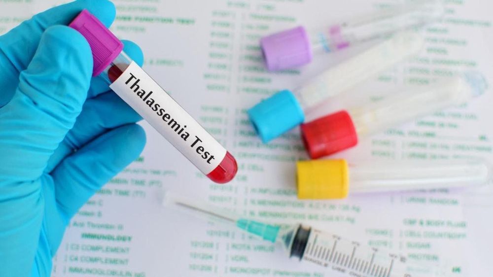 
Xét nghiệm gen giúp phát hiện bệnh Thalassemia
