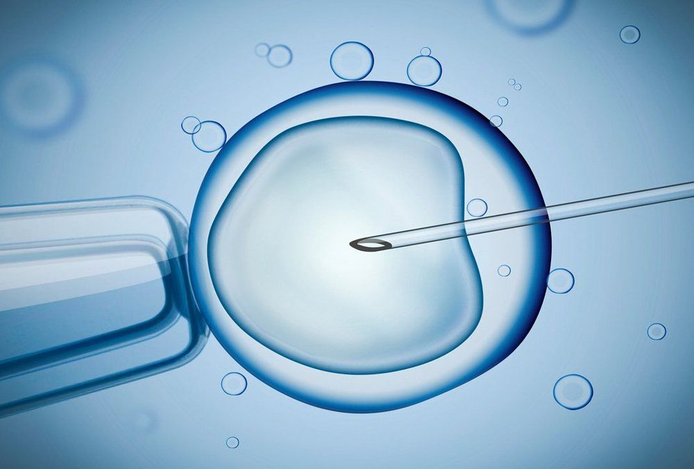 
Công nghệ IVF hỗ trợ sinh sản
