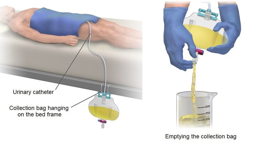 
Đặt ống thông đường tiểu cho bệnh nhân
