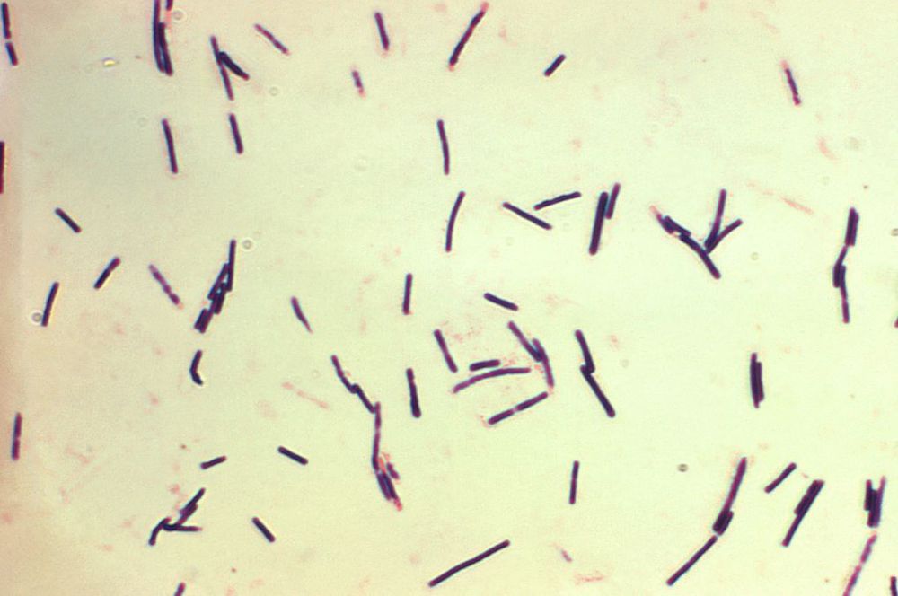 
Vi khuẩn kỵ khí clostridium difficile
