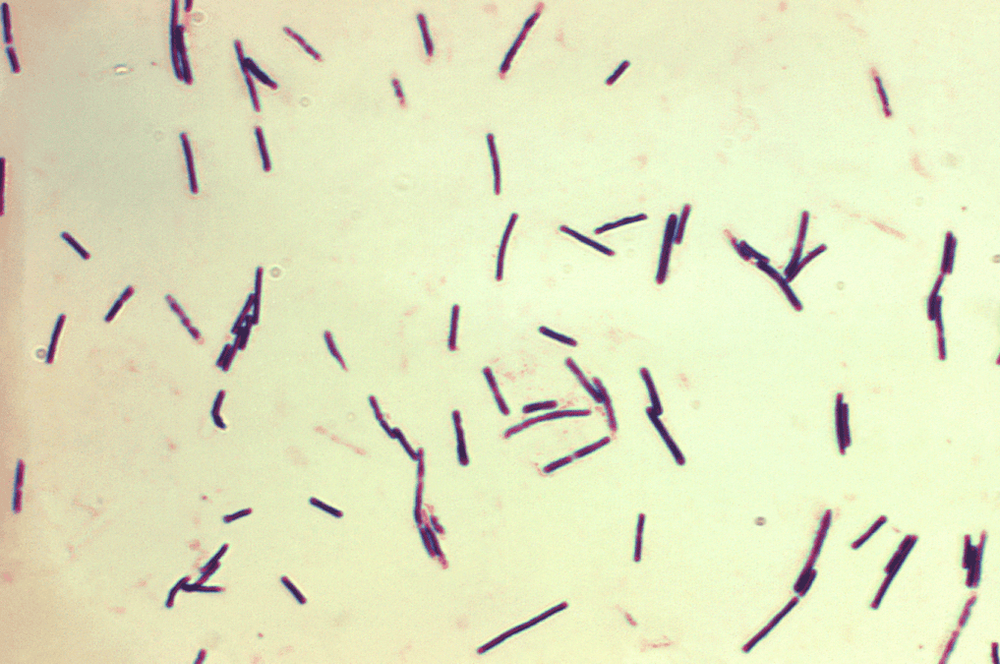 
Vi khuẩn Clostridium
