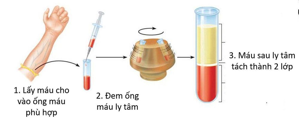 
Máy ly tâm để quan sát cặn nước tiểu qua kính hiển vi
