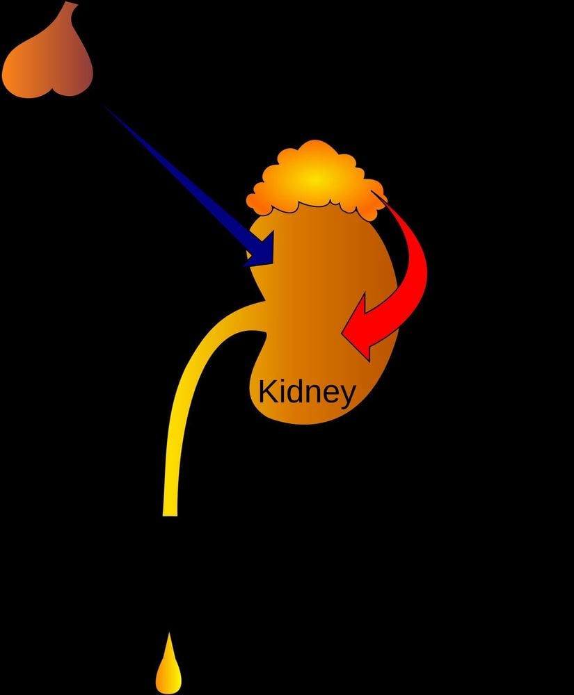 
Hormone chống bài niệu (ADH)
