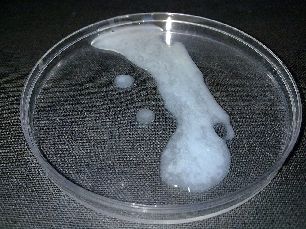 Figure of semen clotting