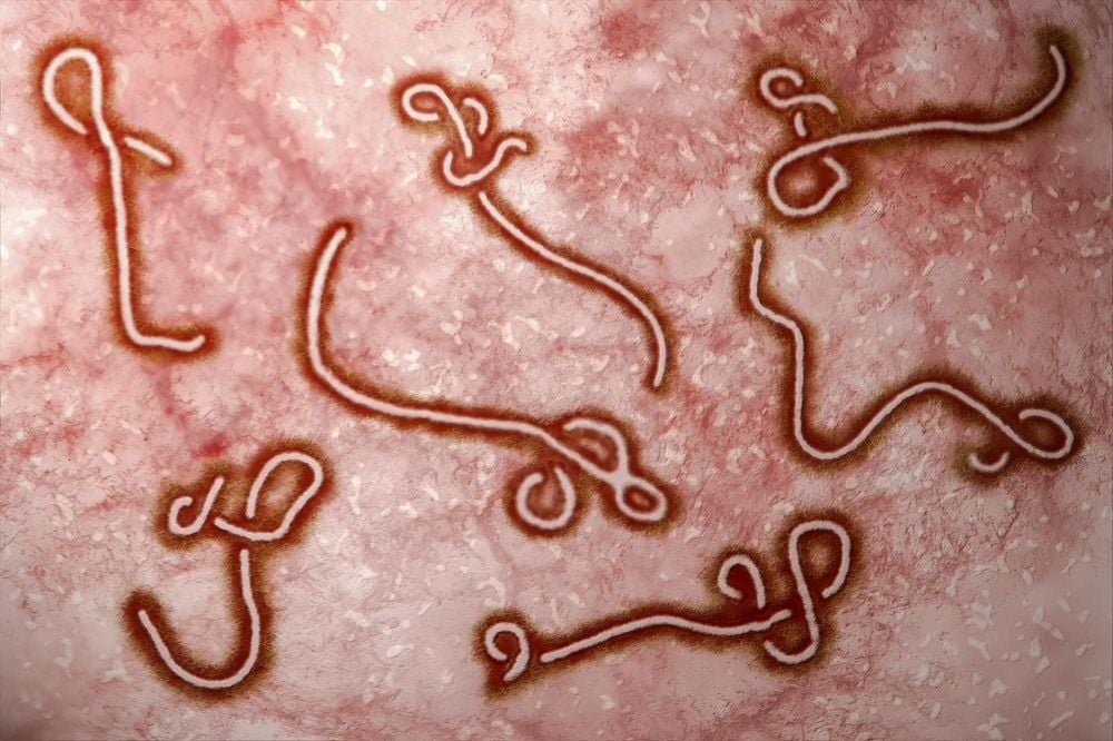 
Hình ảnh virus gây bệnh Ebola
