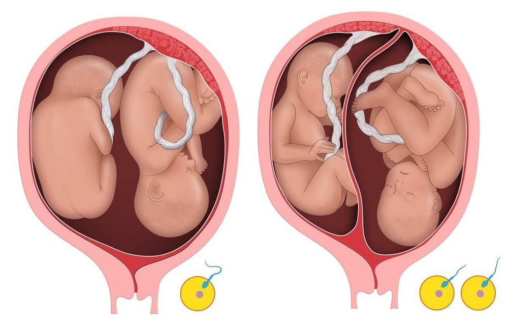 
Thai đôi cần được siêu âm định kỳ
