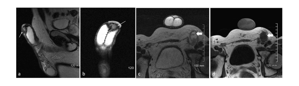 
MRI dương vật cho hình ảnh rõ nét
