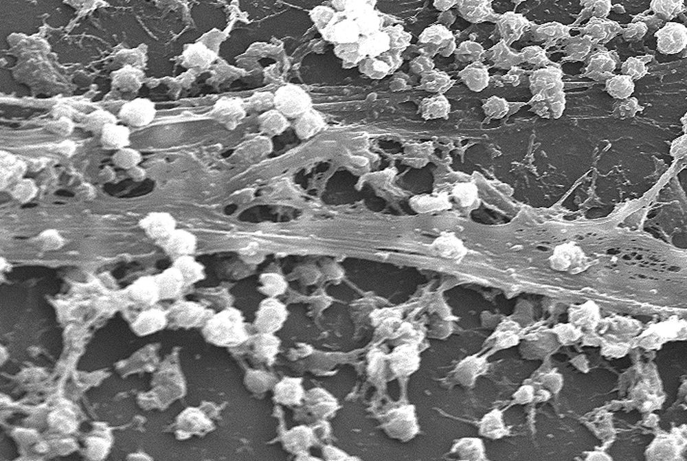 
Sự hình thành Biofilms
