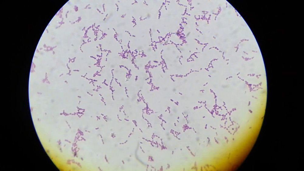 
Vi khuẩn Streptococcus agalactiae gây viêm phổi ở trẻ sơ sinh
